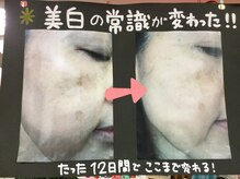 たけみや/VICの常識が変わった！