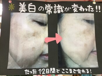 たけみや/VICの常識が変わった！