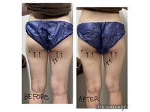 エンチャント(ENCHANT)/細くてもヒップラインは変えれる