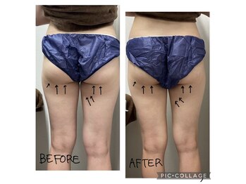 エンチャント(ENCHANT)/細くてもヒップラインは変えれる