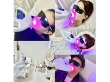 ホワイトニング☆BIO NAIL LINEアカウントよりご予約承ります♪