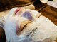 ボーソリューション(Beau-Solution)の写真/【毛穴目立ちの凸凹肌を、なめらかちゅるん肌へ】人気NO.1水光ピーリング¥9900♪無料カウンセリング付き☆