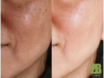 ナンバー19(N°19)/人気のハーブピーリングはこちら