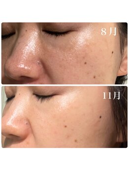 ヒメミ(Himemi)/飲む美白効果付き日焼け止め