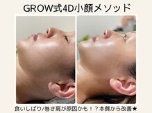 グロウ バイ フェイシャルデザイン アンド アイ(GROW)