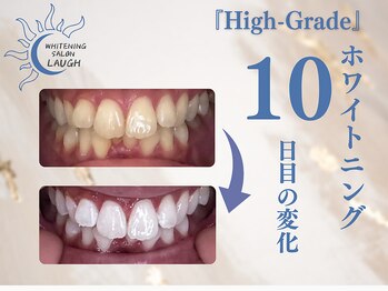 ラフ(LAUGH)/【審・美・白】 ホワイトニング