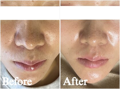 エピナ 千葉店(Epina)の写真