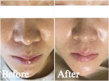 エピナ 千葉店(Epina)