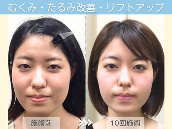 小顔矯正専門店 シンメトリー 梅田