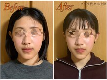 ブプラ 代々木上原店(BUPURA)/小顔×肌質改善