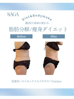 ユニクリア(Uni clear)/佐賀市ユニクリア・痩身エステ