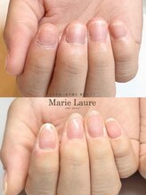 マリーロール 梅田店(Marie Laure)/自爪育成/深爪矯正/ネイルケア