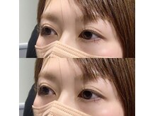 ナイア(nai'a)/フラットマット120本