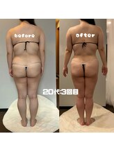 ソウソウビューティー 五反田(Shou Shou Beauty)/ビフォー★アフター