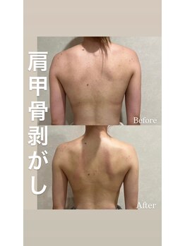 リエイト(Lieto)/肩甲骨剥がし