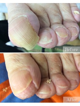 ドクターネイル爪革命 THE KANAZAWA 御経塚/肥厚爪ケア