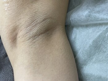 ナノハナ/鹿沼市の全身脱毛美容室ナノハナ