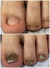 グレースレディ 神戸北店/