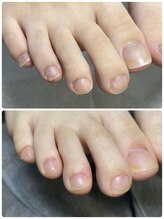カラー(calla)/フットケアで健康的な足元へ