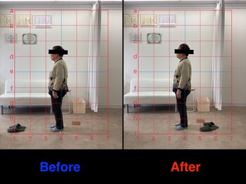 整体院 仁(JIN)/#ぎっくり背中#背部の痛み#腰痛