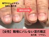 【１番人気お試し】女性●最短120分で見た目が変わる深爪矯正￥23100→