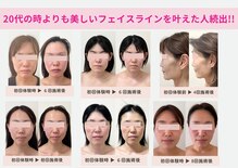 ラヴィ(Lavie)