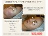 【全顔集中ケア】ハーブ導入で美肌リセットケア ￥22,000
