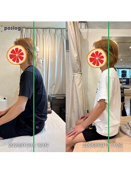 グレフル鍼灸接骨院 整体院 心斎橋/整体/肩こり/マッサージ/腰痛