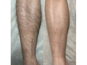 ミーフォレスト(Mi Forest)/