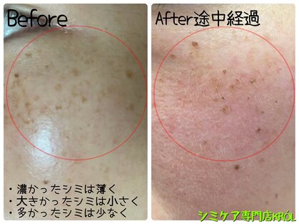 クルル(KROL)の写真