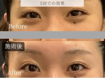 ブリリオ 池袋店(Brillio)/1回での効果