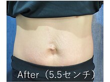 カナウ(kanau)/トリプルボディシェイプ