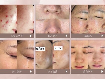 ホワイトアクア 三ノ宮店(WHITE AQUA)の写真