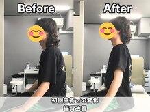 整体院 ワン(ONE)の雰囲気（肩のだるさや腕の痺れに対して整体、姿勢改善の例となります。）
