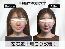 ハリユナイテッド 原宿鍼灸 整体院(HALI UNITED)/左右差なく肩こりも改善！