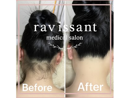 ラヴィソン(ravissant)の写真