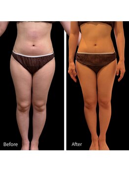 クールヴィラ(Cool Villa)/冷却2ヶ月での変化