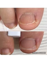ネイルプルーフ(NAIL proof)/