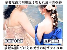 ボナボナ 仙台立町(BONA BONA)の雰囲気(【短期集中】埋もれ肩甲骨/肩の盛り上がり/鎖骨埋もれ/コルギ)