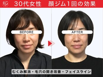 顔ジム 麻布店/30代女性顔ジム1回の効果