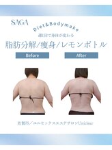 ユニクリア(Uni clear)/佐賀市│人気の痩身エステ