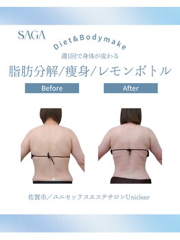 ユニクリア(Uni clear)/佐賀市│人気の痩身エステ