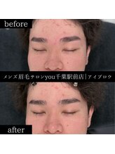 ユー 千葉駅前店(you)/ビフォ－アフター写真