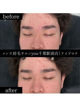 ユー 千葉駅前店(you)/ビフォ－アフター写真