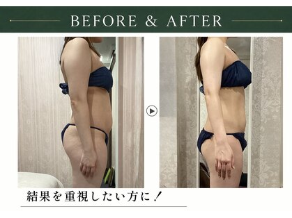 アディッシモ(addissimo)の写真
