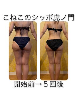 こねこのシッポ 虎ノ門/大人気！サーモシェイプdeep