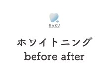 ハク 高槻店(HAKU)/【ビフォーアフター】