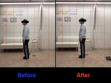 整体院 仁(JIN)/#お尻の痛み#座ると痛い#梨状筋