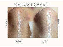 サロンドエー 帝塚山(Salon de A)/毛穴の汚れは、もう要らない！