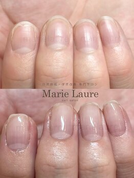 マリーロール 淀屋橋本店(Marie Laure)/自爪育成/深爪矯正/ネイルケア